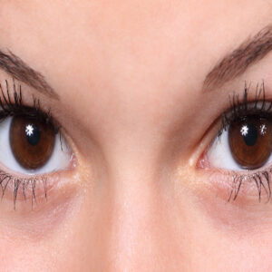 Iridology course