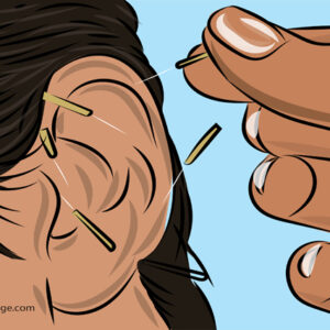 Auriculotherapy course