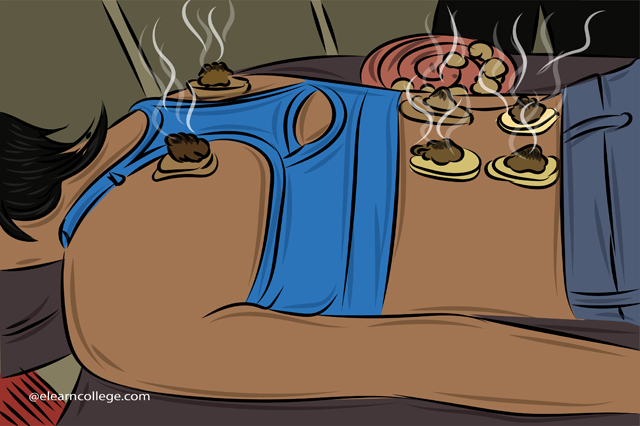 Moxibustion