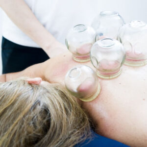 Cupping Therapy course