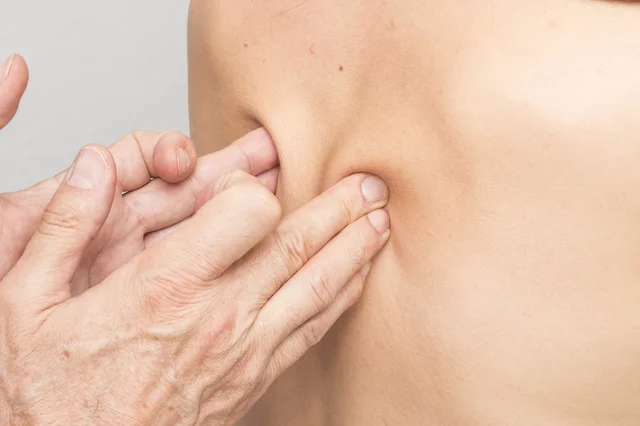 Myofascial Release Therapy course