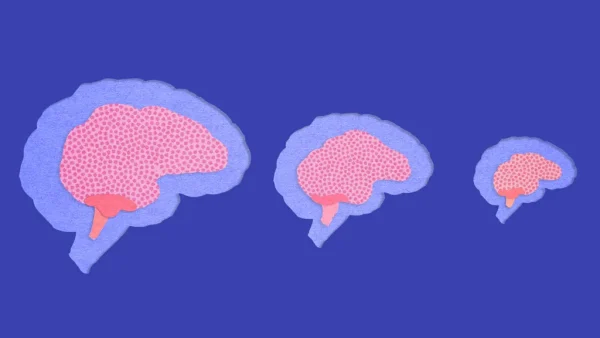 brain size 