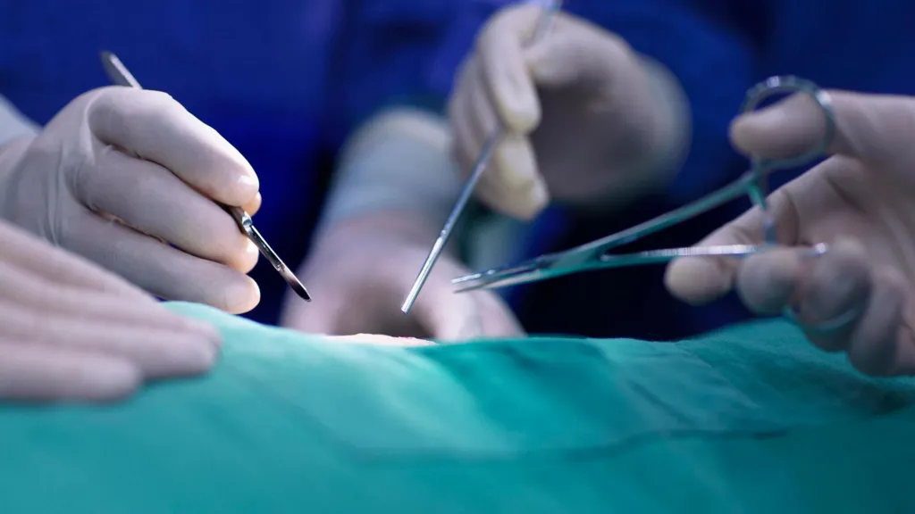 Organ Trade