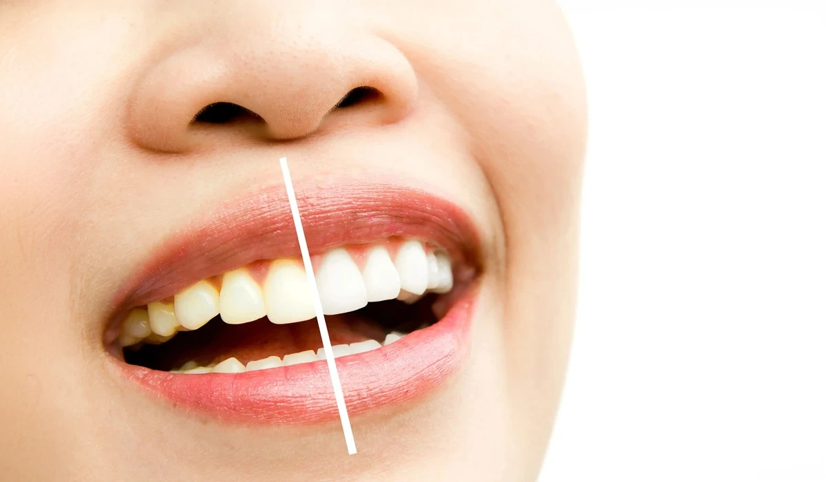 featured-image