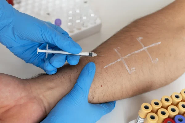 apillary blood collection methods
